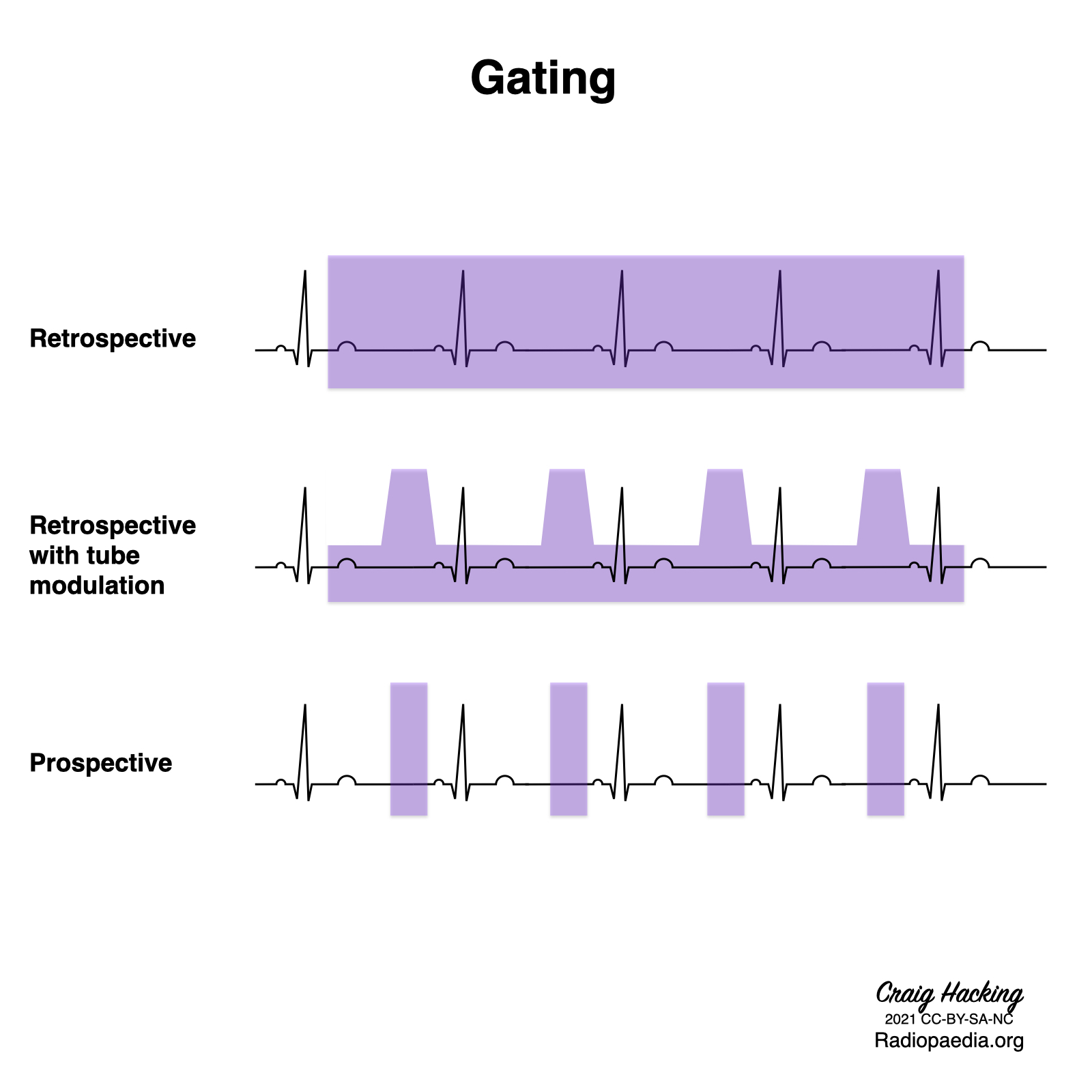 ecg-gating-diagrams-image-radiopaedia