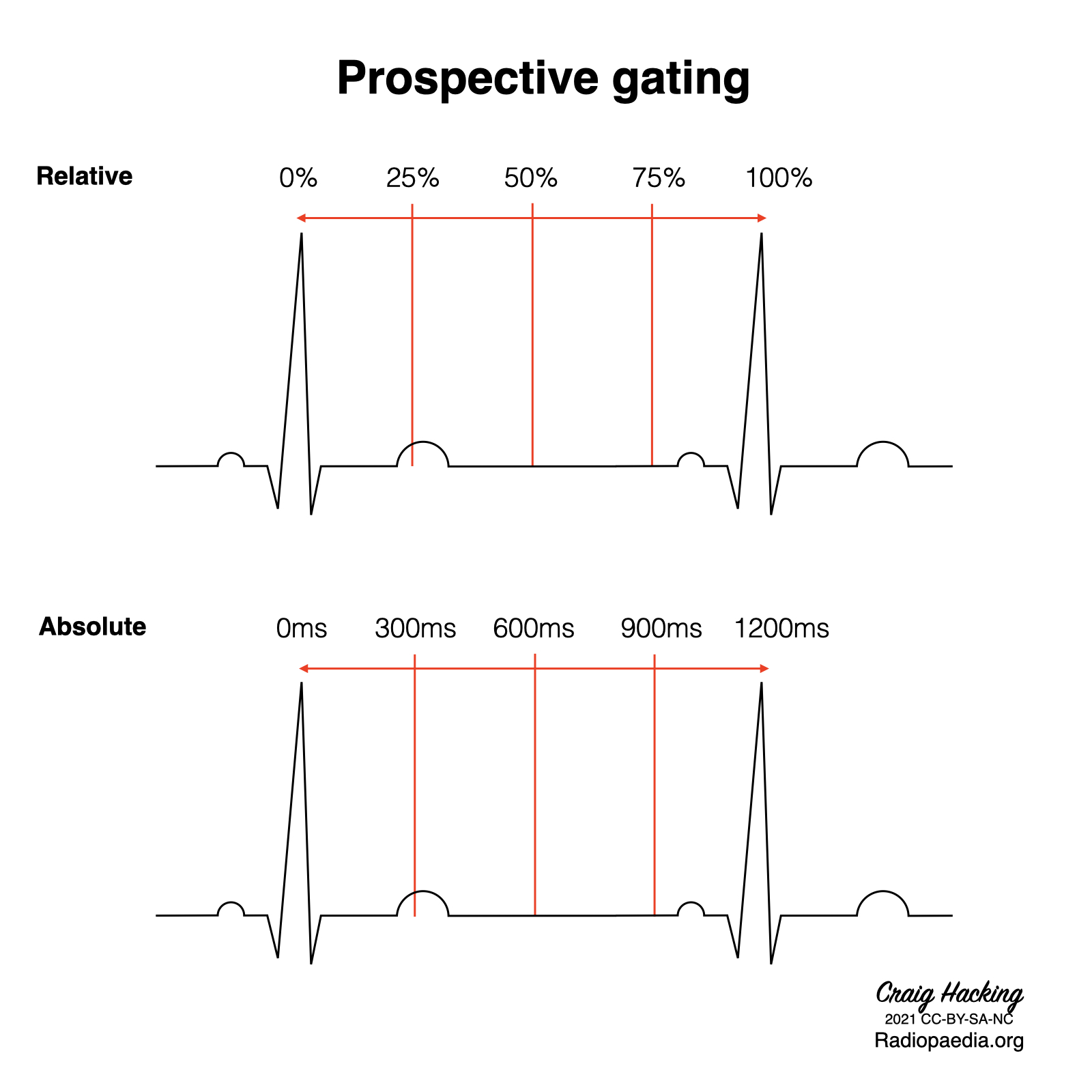 ecg-gating-diagrams-image-radiopaedia