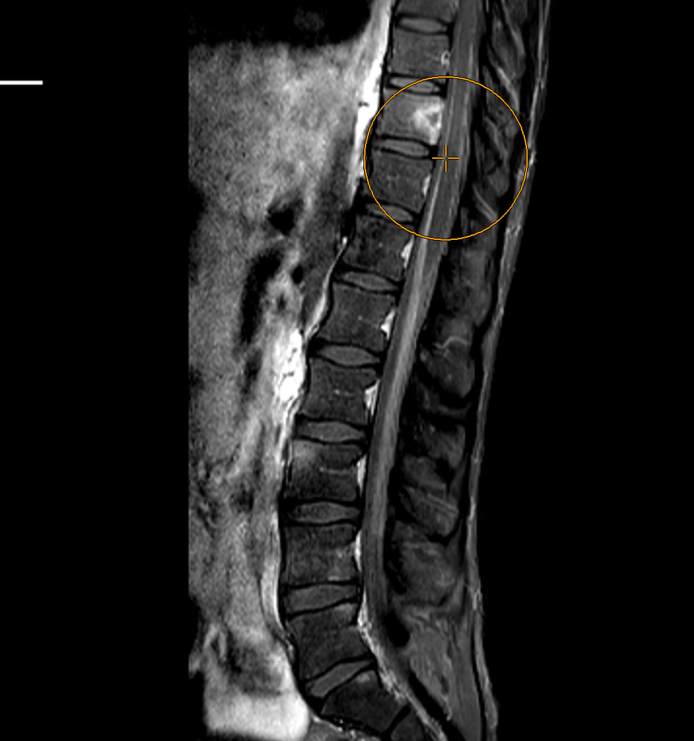 Image | Radiopaedia.org