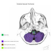 Venous vascular territories of the lateral cerebral cortex (illustration), Radiology Case