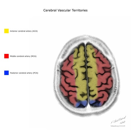 Brain arterial vascular territories | Radiology Reference Article ...