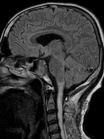 Radiology Quiz 10854 | Radiopaedia.org