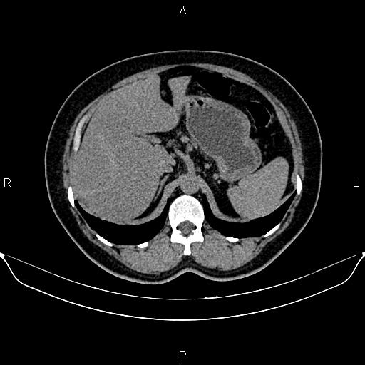 Image | Radiopaedia.org