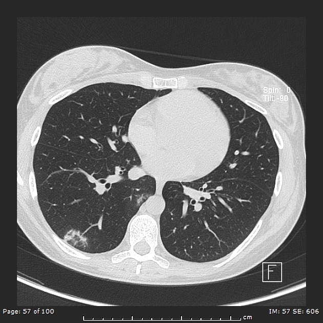 Items a significant at selected one frist cover by random operation with related geplante