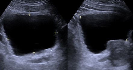 Images | Radiopaedia.org