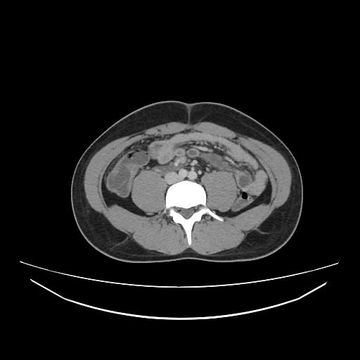 Image | Radiopaedia.org