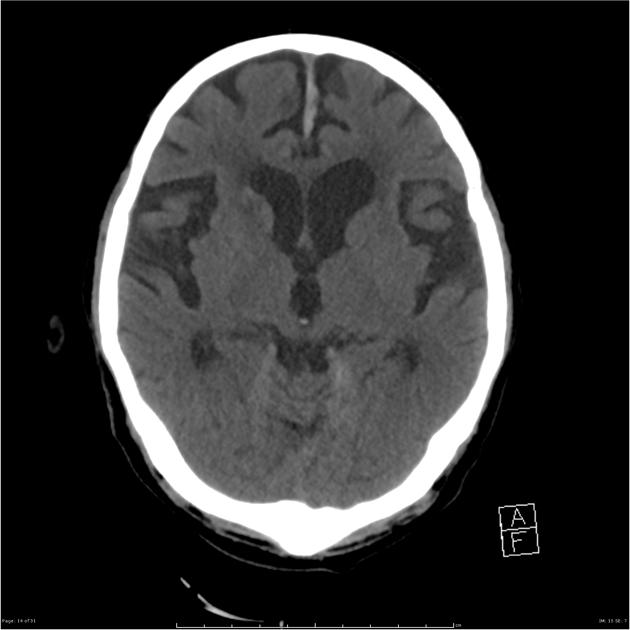 Radiology Quiz 26695 | Radiopaedia.org