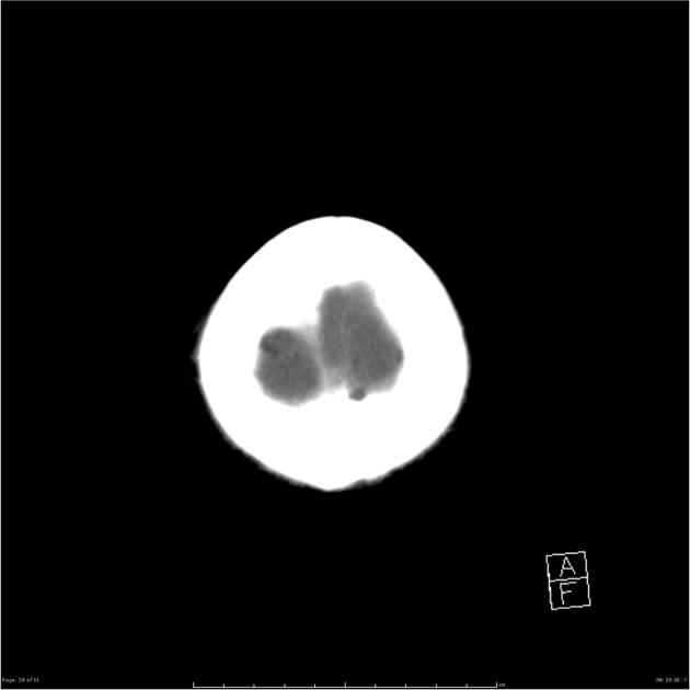 Radiology Quiz 26695 | Radiopaedia.org