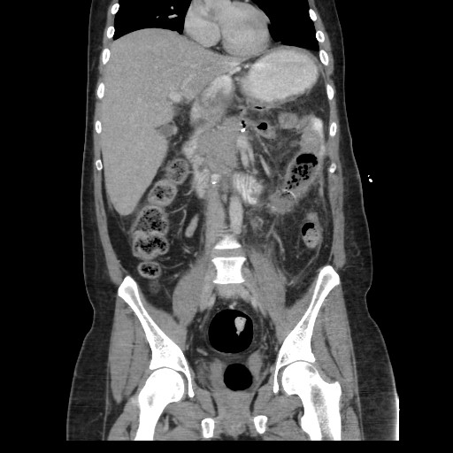 Images | Radiopaedia.org