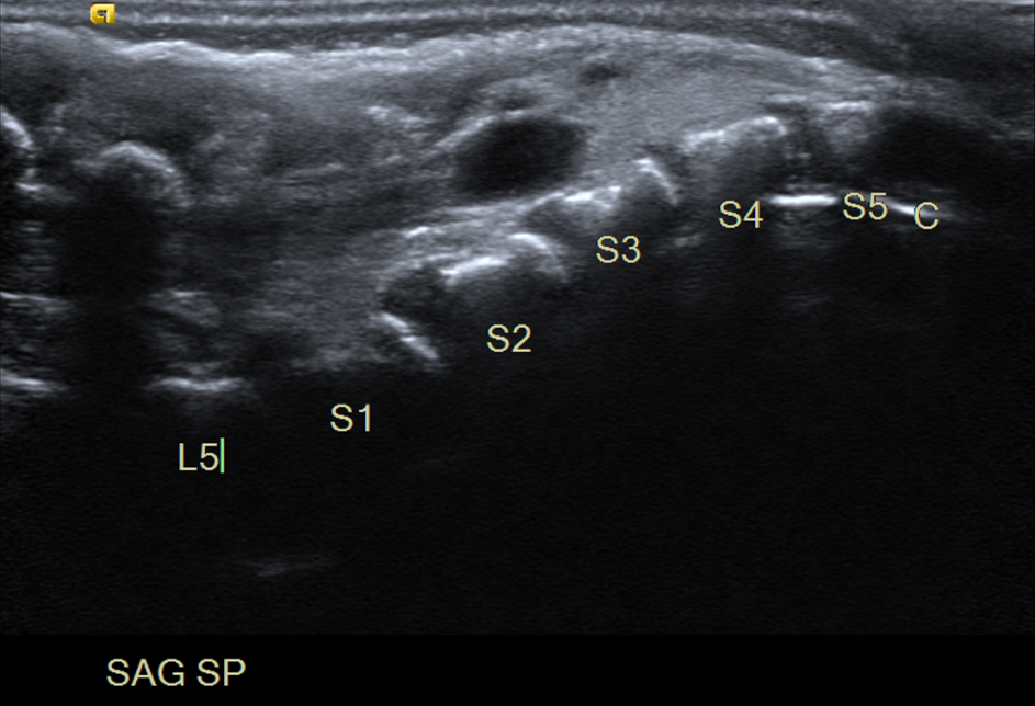 Image | Radiopaedia.org