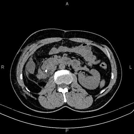 Image | Radiopaedia.org