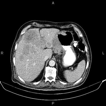 Radiology Quiz 89405 | Radiopaedia.org