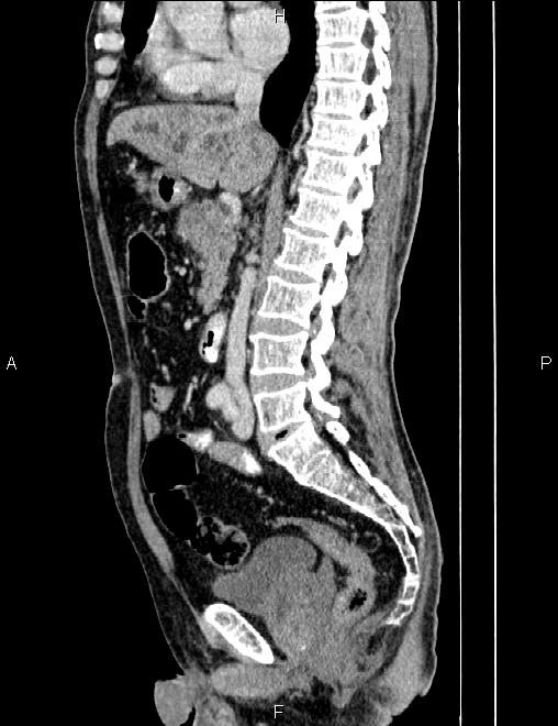 Image | Radiopaedia.org