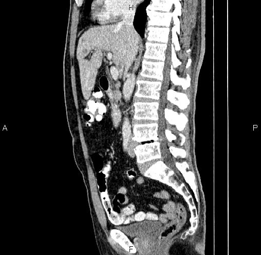 Image | Radiopaedia.org