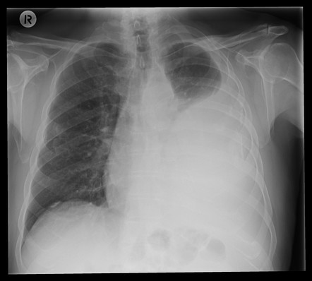 Playlist 'Chest radiology' by Filip Milošević