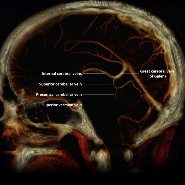 The larger superficial cerebral veins, including those draining the