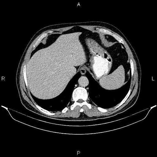 Radiology Quiz 90243 | Radiopaedia.org