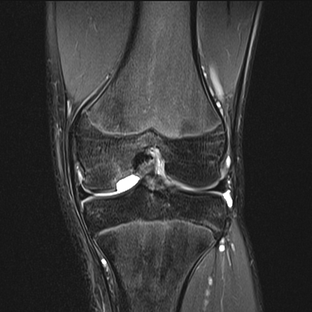 Radiology Quiz 90555 | Radiopaedia.org