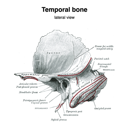 Temporal Bone Radiology Reference Article Radiopaedia Org