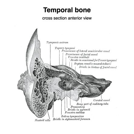 Temporal bone | Radiology Reference Article | Radiopaedia.org