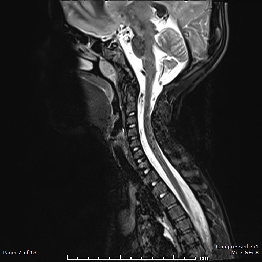 Image | Radiopaedia.org