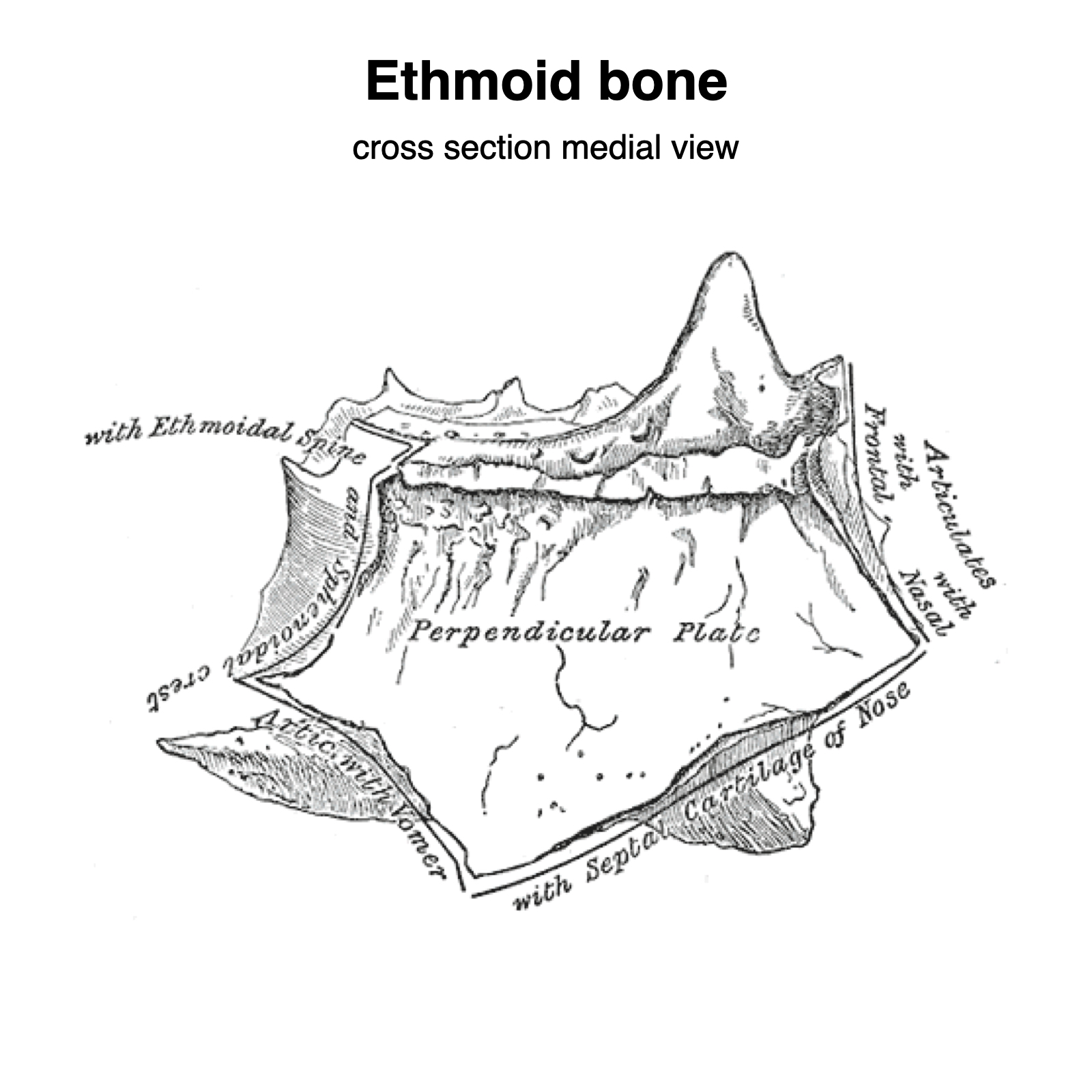 Image | Radiopaedia.org