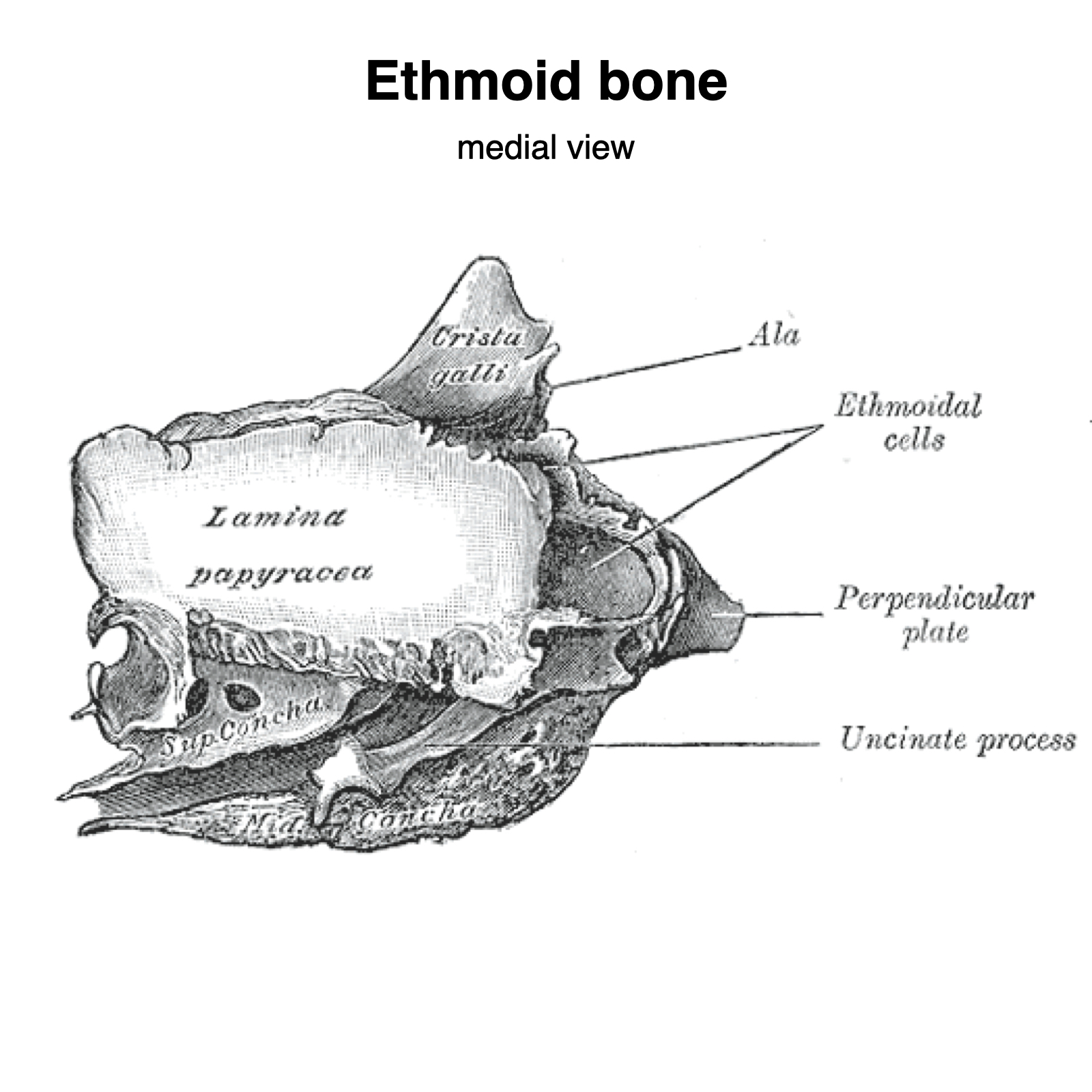 Image | Radiopaedia.org