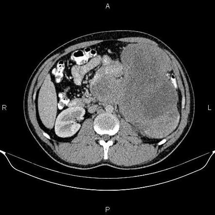 Radiology Quiz 91142 | Radiopaedia.org