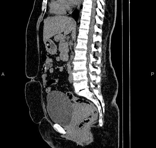 Image | Radiopaedia.org