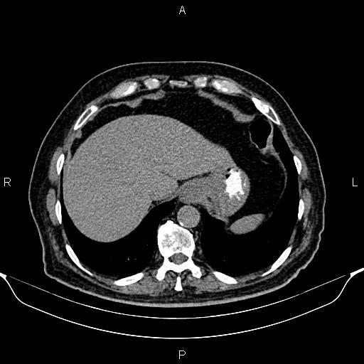 Image | Radiopaedia.org