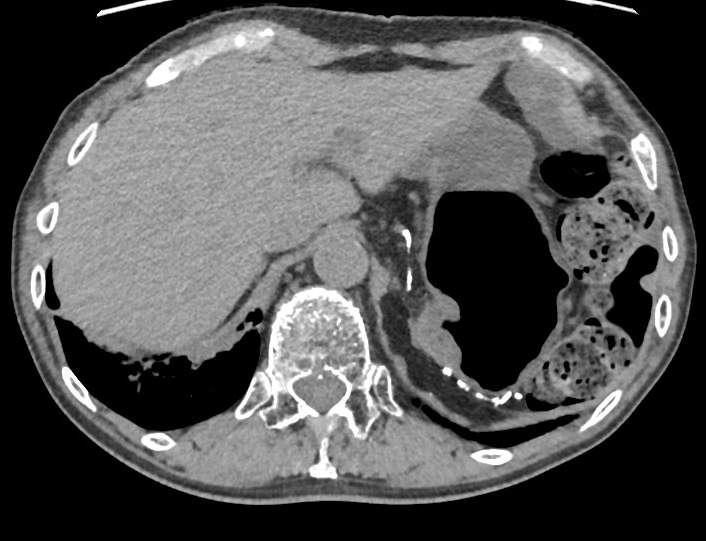 image-radiopaedia