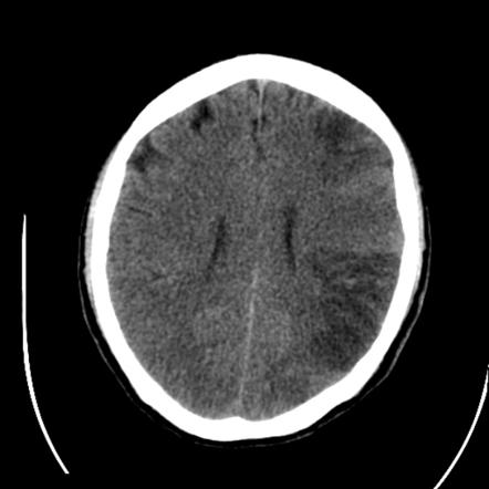 Viewing playlist: VASCULAR | Radiopaedia.org