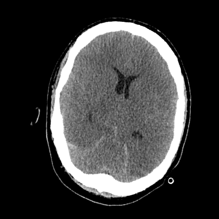 Radiology Quiz 92991 | Radiopaedia.org