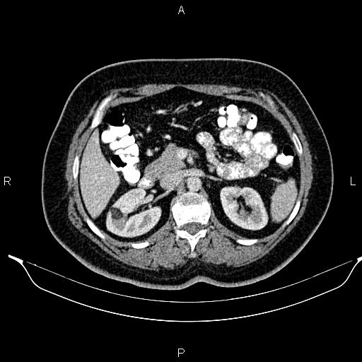 Image | Radiopaedia.org