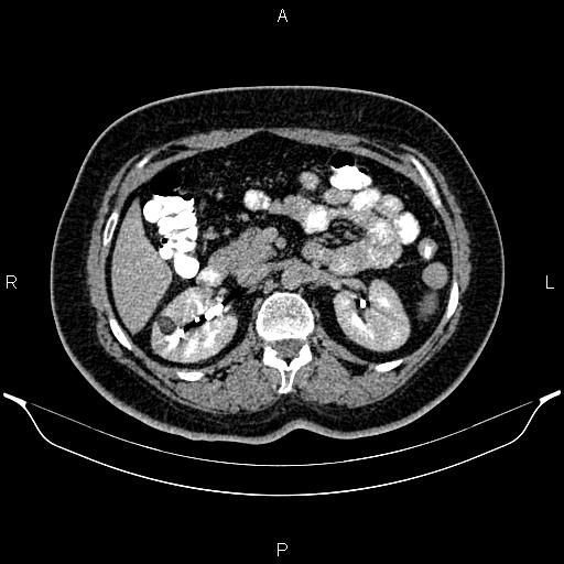 Image | Radiopaedia.org