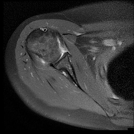 Radiology Quiz 93171 | Radiopaedia.org