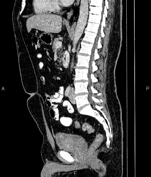 Image | Radiopaedia.org