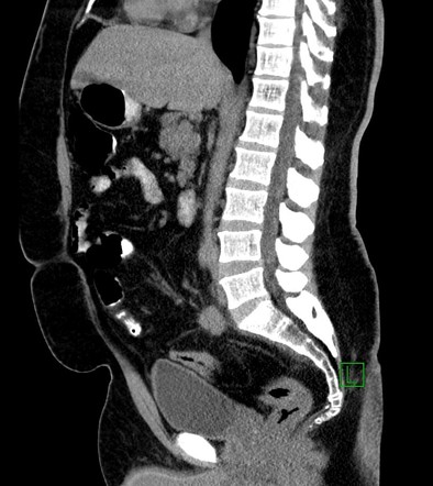 Image | Radiopaedia.org