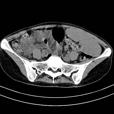 Radiology Quiz Radiopaedia Org