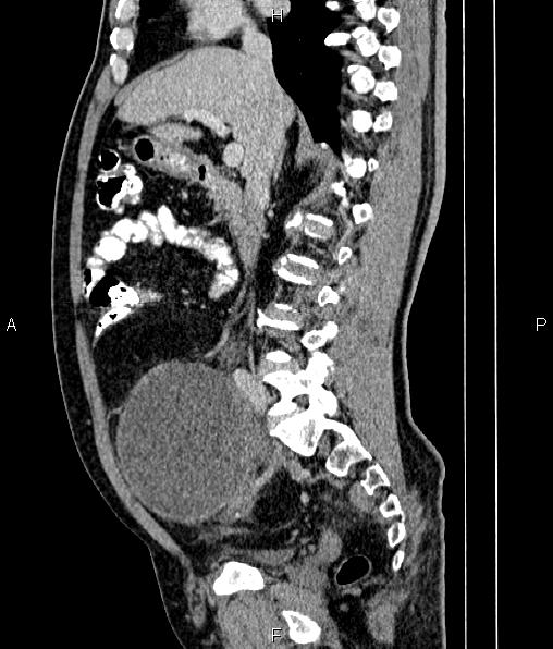 Image | Radiopaedia.org