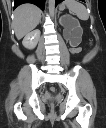 Radiology Quiz 93553 | Radiopaedia.org