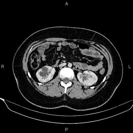 Image | Radiopaedia.org