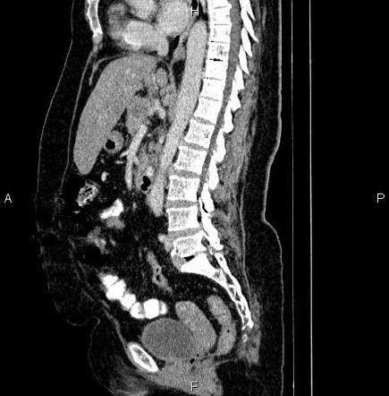 Image | Radiopaedia.org