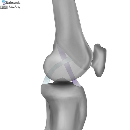 Image | Radiopaedia.org