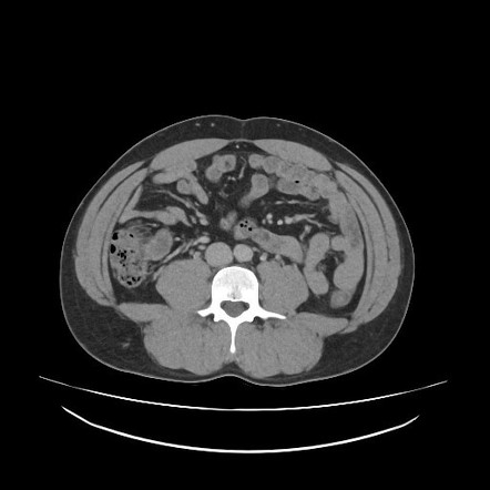 Images | Radiopaedia.org