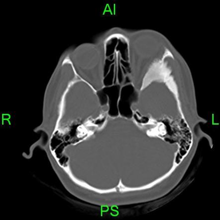 Image | Radiopaedia.org