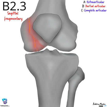 Image | Radiopaedia.org