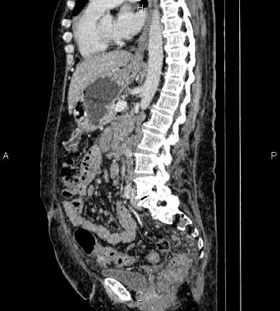 Image | Radiopaedia.org