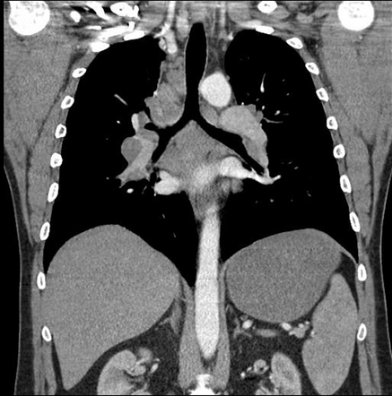 Radiology Quiz 94115 | Radiopaedia.org