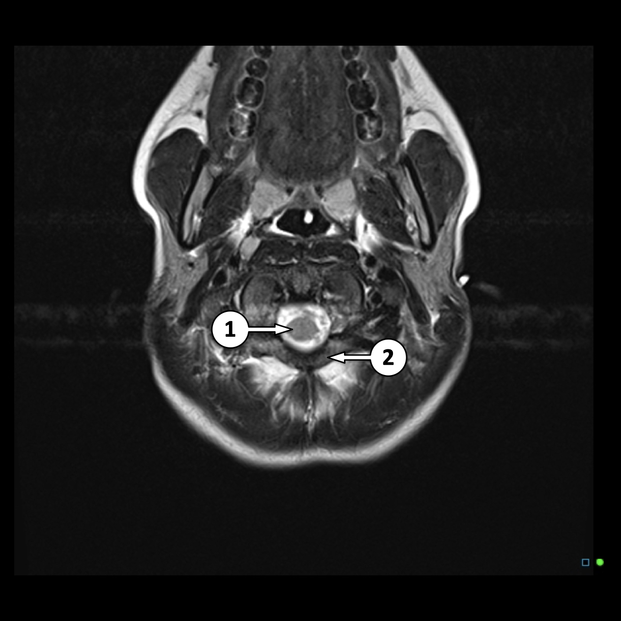 Image | Radiopaedia.org